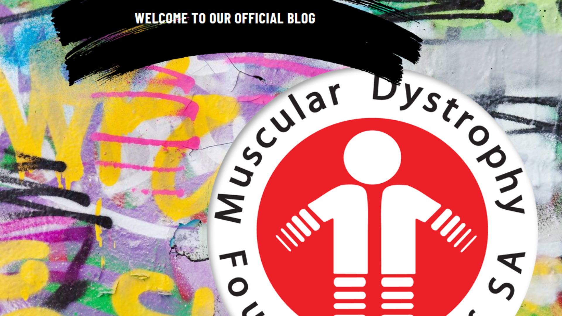 Myotonic dystrophy (DM)