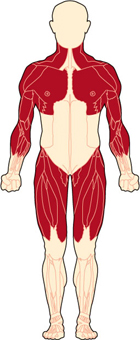 Becker Muscular Dystrophy (BMD)