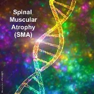 Spinal Muscular Atrophy (SMA)