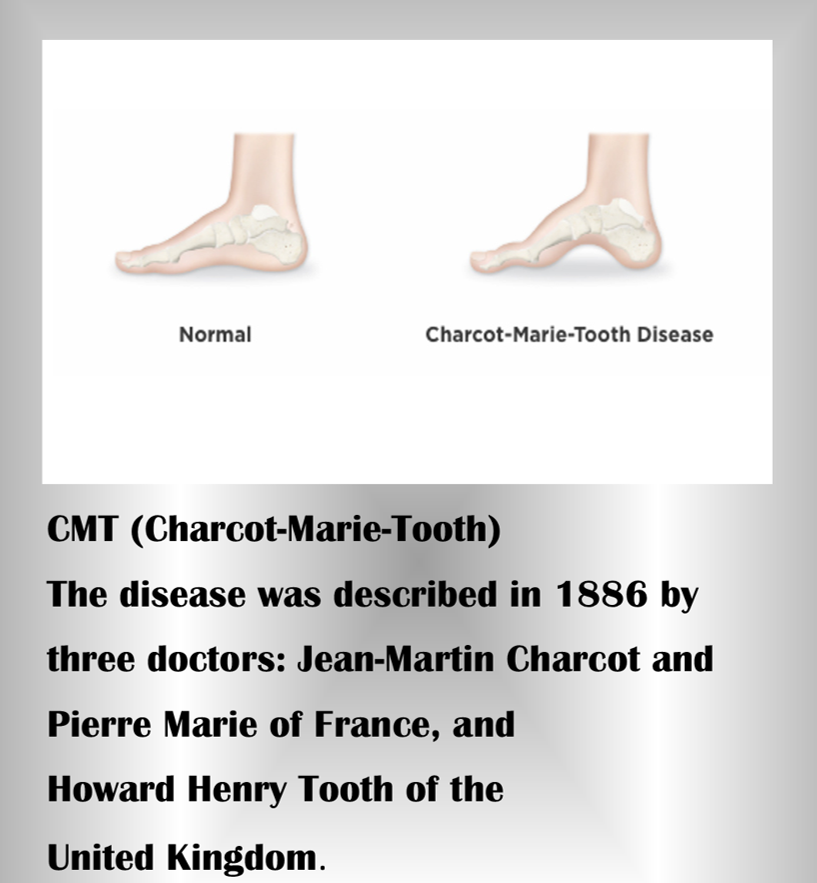 Charcot-Marie-Tooth Disease (CMT)
